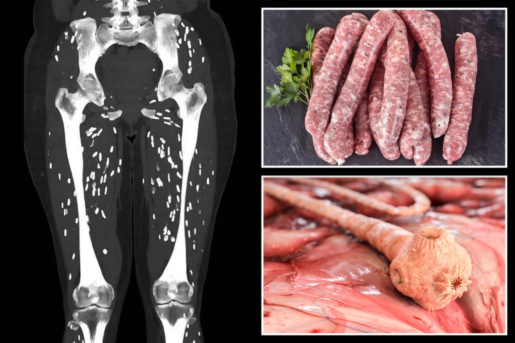 nypost's tweet photo. Horrific scan shows the devastating effects of undercooked pork on the body https://t.co/H9GVQ0dSyb https://t.co/scr65tEWba