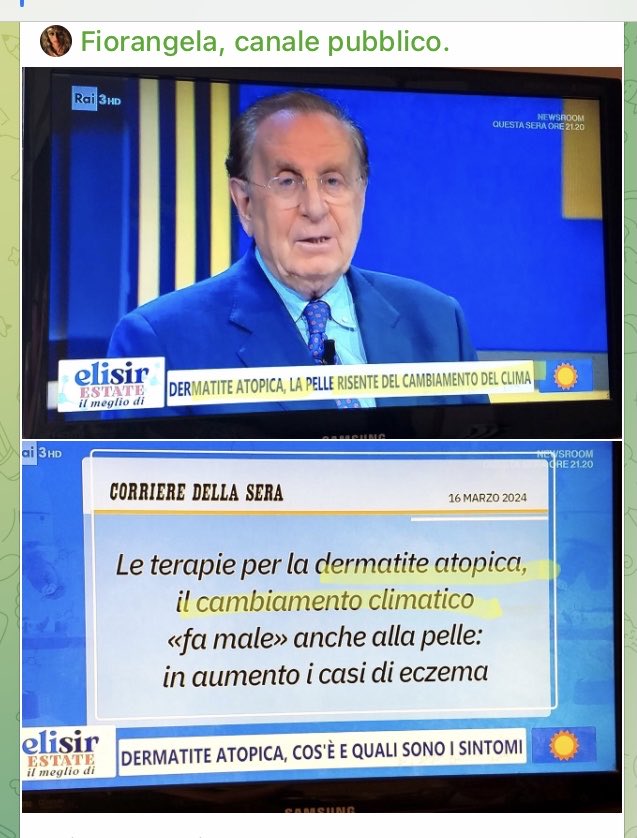 HBritaly's tweet photo. 🤡😂BUON GIORNO 😂🤡
Michele #Mirabella presenta:
Il cambiamento climatico tra i fattori scatenanti della #dermatite atopica.
_GiorgioBianchi_ https://t.co/ydCmnEZpZg