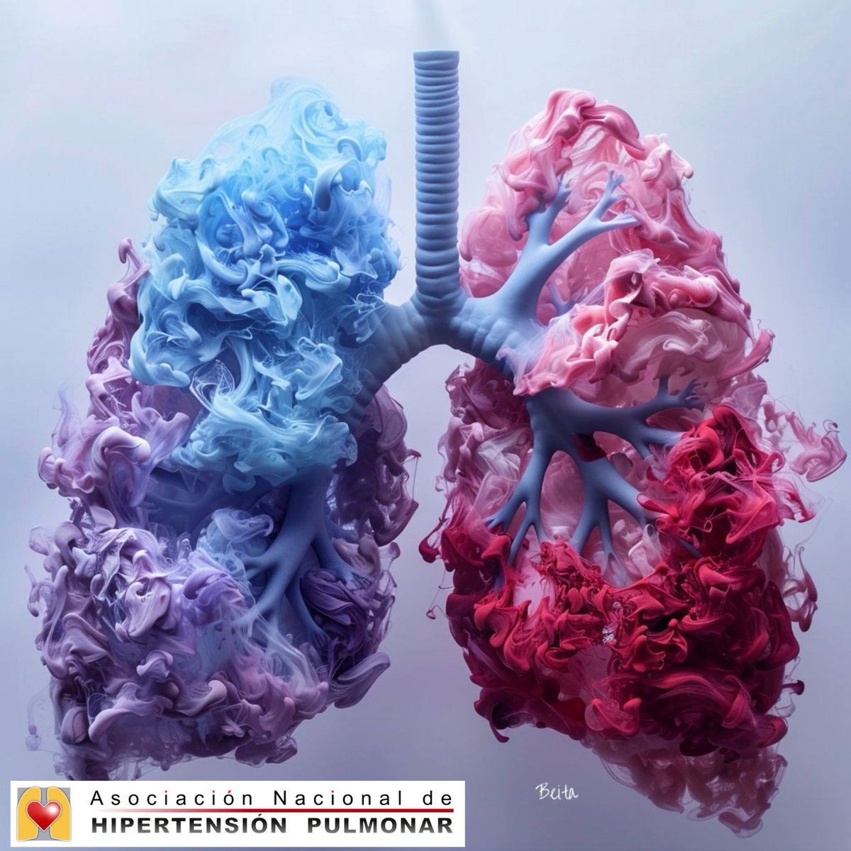 ANdHP's tweet photo. INVESTIGACIÓN

Un nuevo estudio realizado por investigadores de UCLA Health y organizaciones colaboradoras ha descubierto que la asporina, una proteína codificada por el gen ASPN, desempeña un papel protector en la hipertensión arterial pulmonar (HAP).

https://t.co/pCJ3kqIyIe https://t.co/wL6aiE90yB