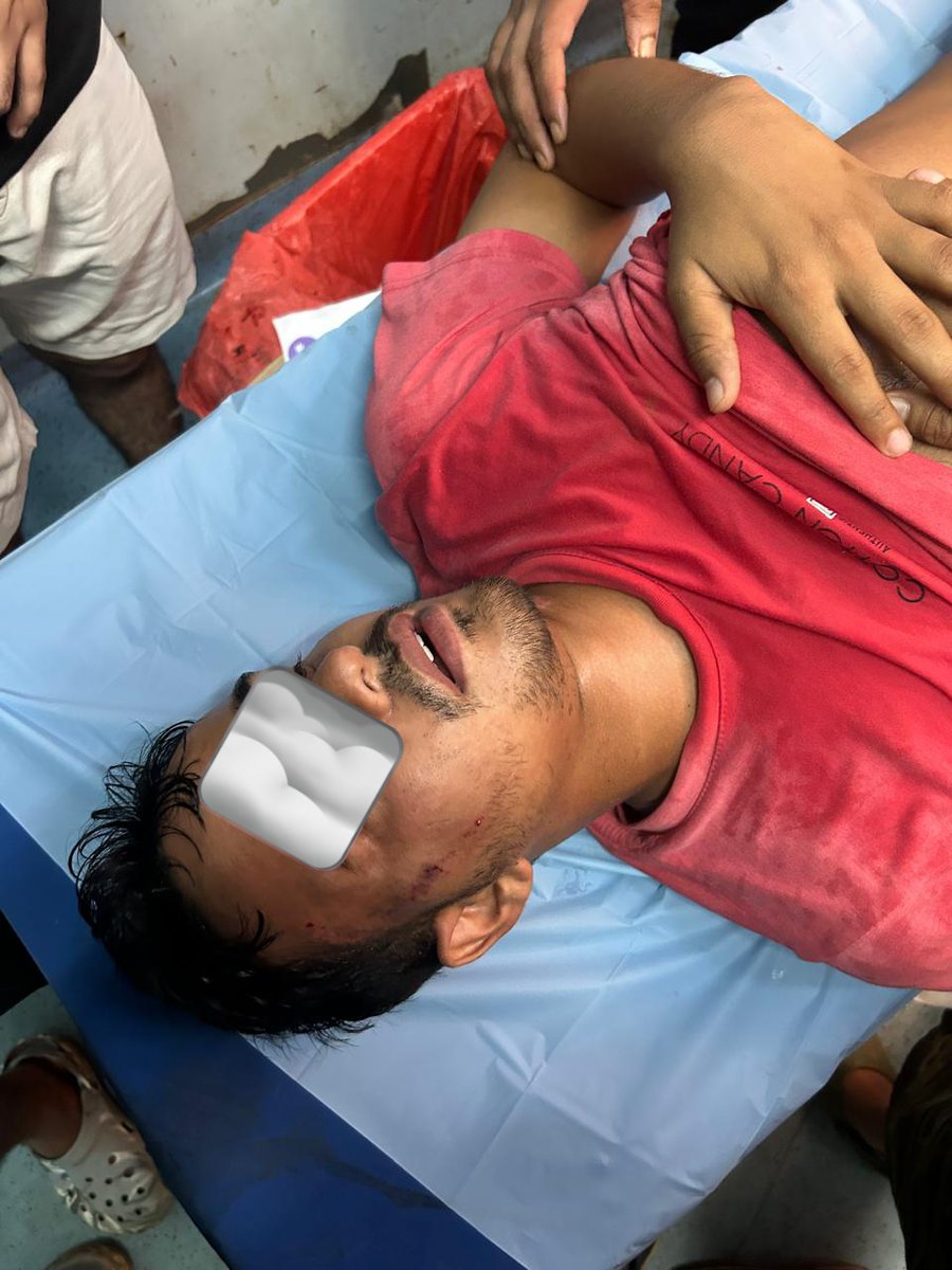 Indian__doctor's tweet photo. Horrifying! 
Brutal Attack on RIMS #RANCHI Medical students by approx 150- 200 drunk Home Guard deployed in Hostel Hospital.

Students sustained severe injuries like fracture in Zygomatic bone &amp; blood in maxillary sinus
@JharkhandCMO @PMOIndia @AmitShah @narendramodi
#MedTwitter https://t.co/fSHRu8nVSN