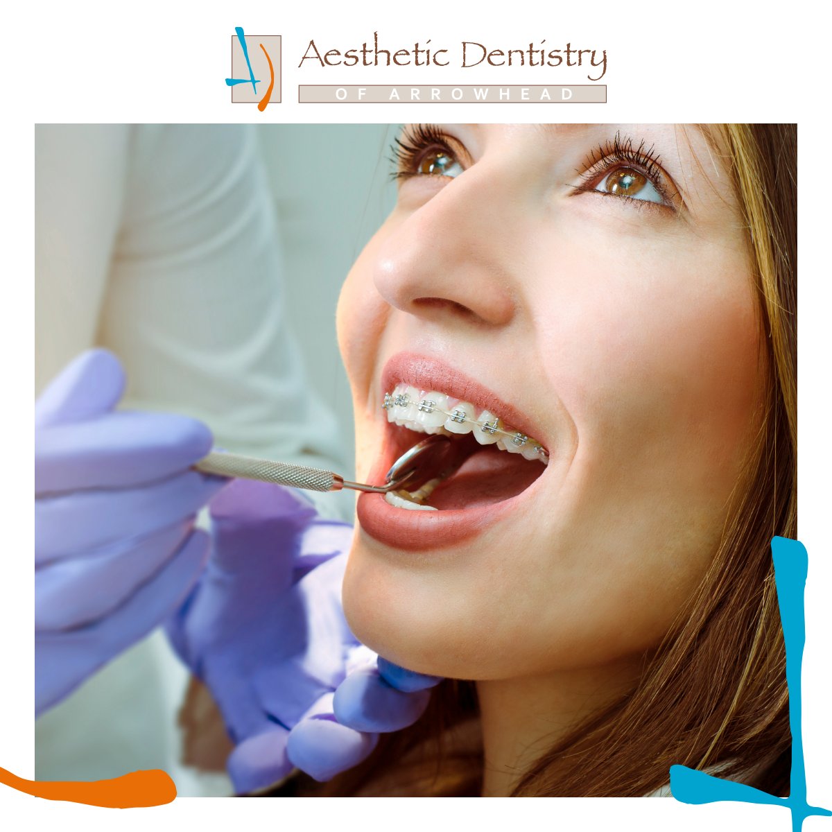 Did you know braces could be a great ally in your oral health journey? They help straighten teeth, enhance oral hygiene, correct bite issues, and improve jaw joint health. Discover the benefits of braces and start your path to better oral health today! 🦷 📞 614-252-3181