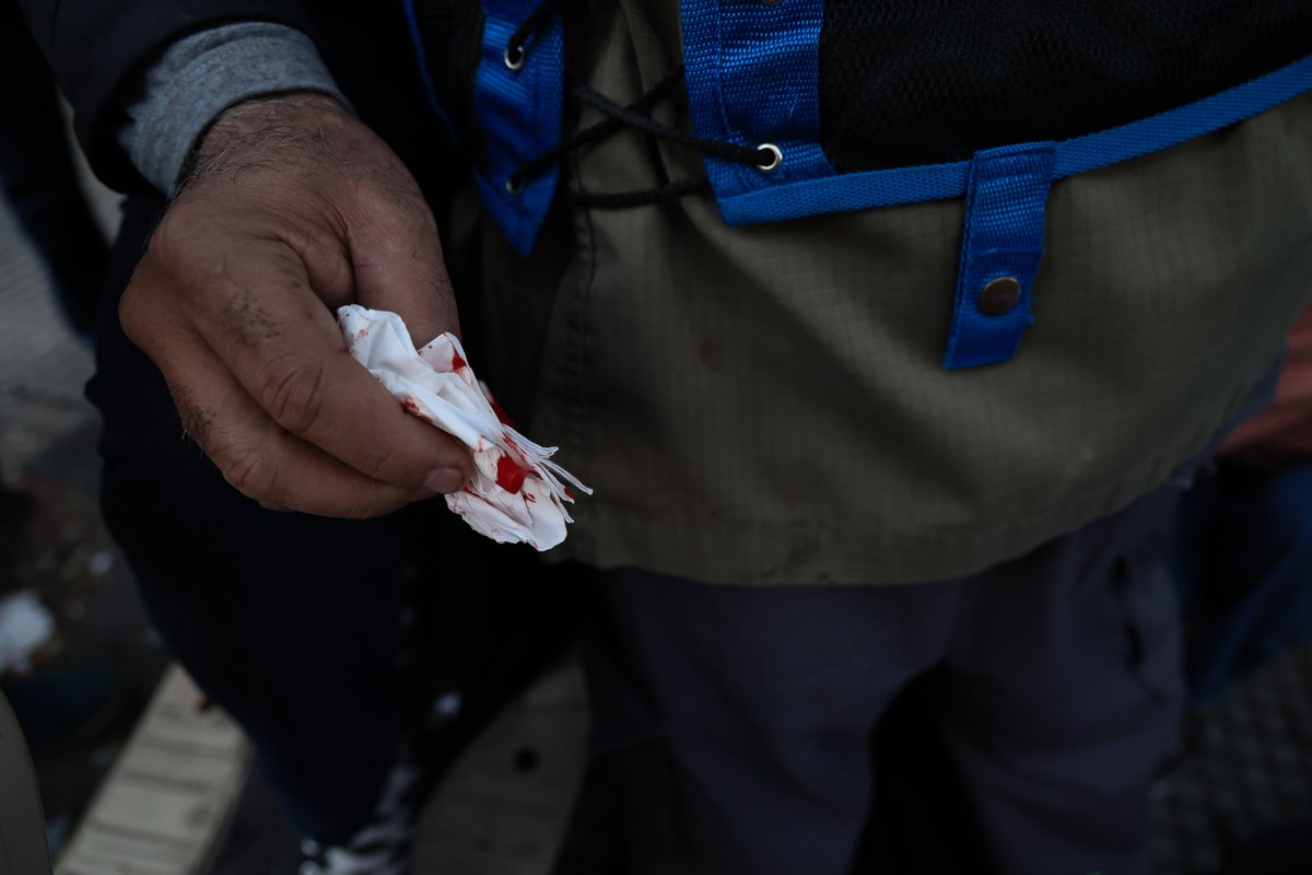 Represión en el Congreso a la peligrosa casta de jubilados y jubiladas que reclaman que un haber menor a 300 mil pesos es igual a morir de hambre. La respuesta es palo. Plata hay… pero las prioridades son otras en el Gobierno liberal. 
📷 <a href="/adrodrigoruiz/">Rodrigo Ruiz</a>