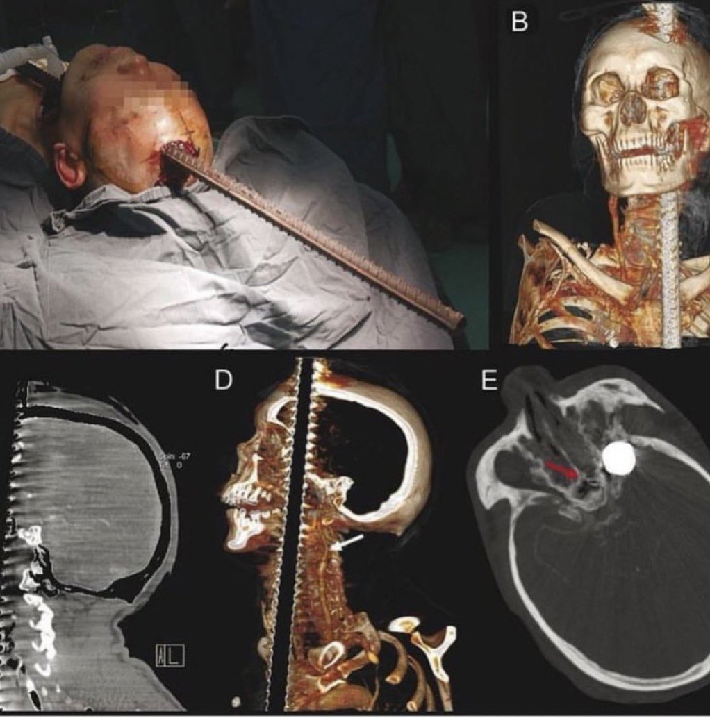 Dr. Mohammed Al-Mahri د. محمد المهري tweet media