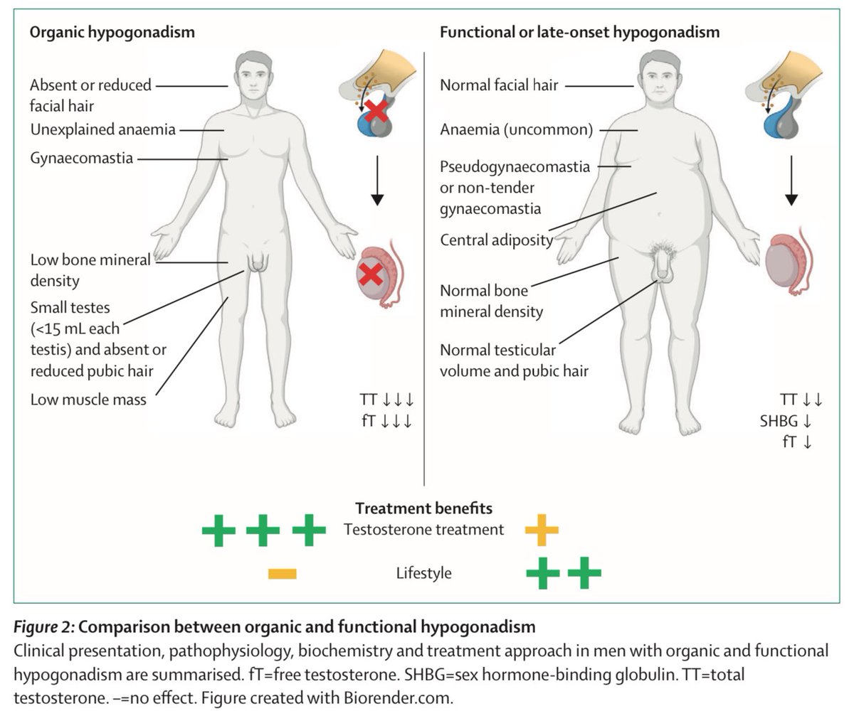 Organic vs Functional hypogonadism : pubmed.ncbi.nlm.nih.gov/39159641/