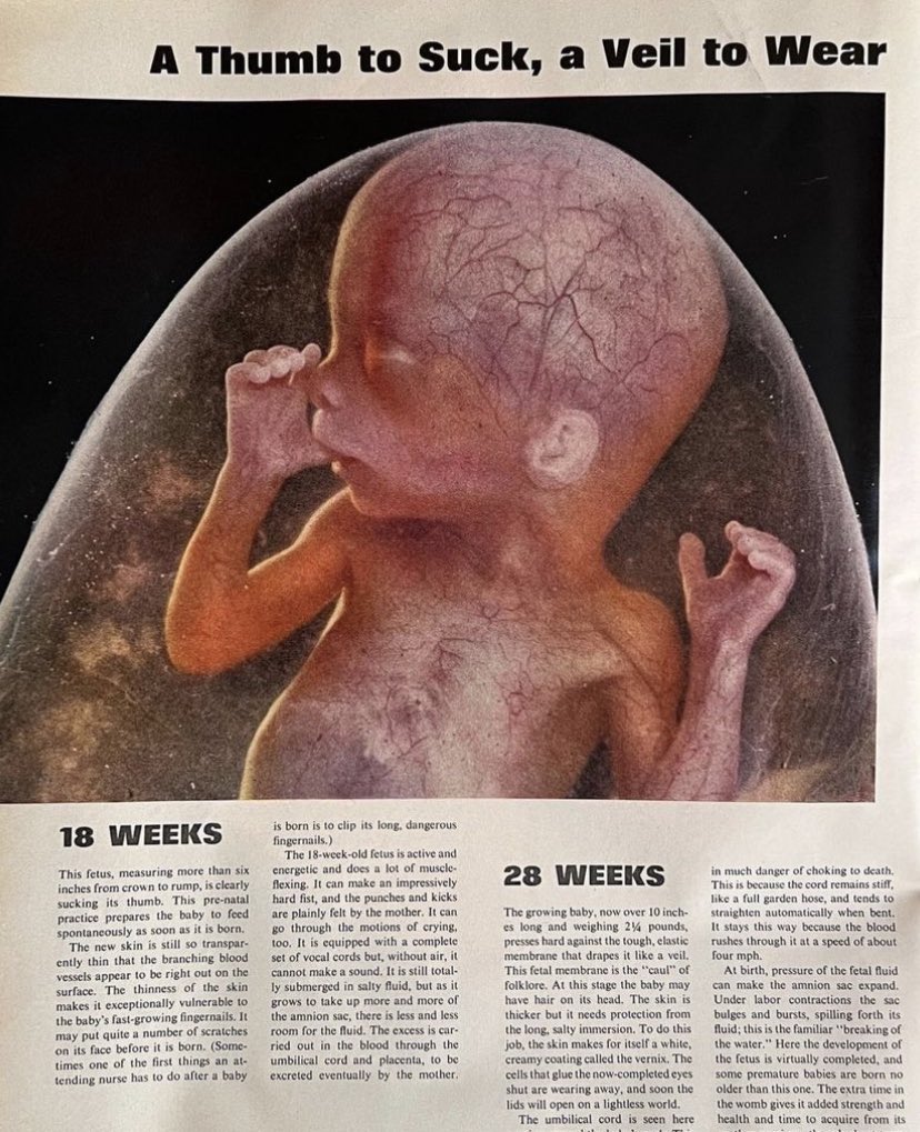 annamlulis's tweet photo. Modern media: “They’re just a clump of cells”

Life Magazine, 1965: https://t.co/8JoxRBtU7y
