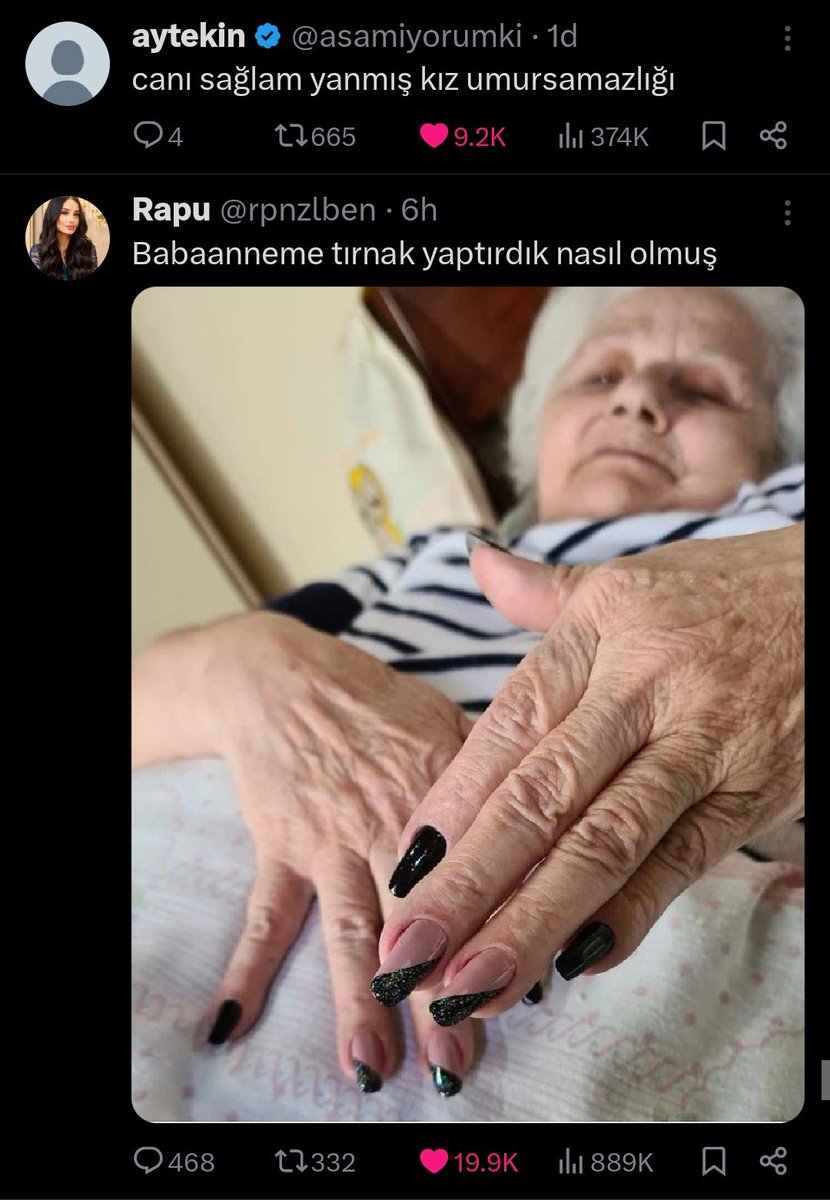 tam olarak bu