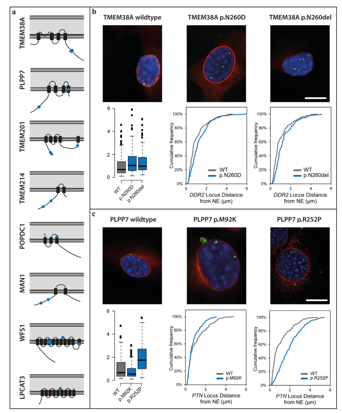 nikakhtar_ali's tweet photo. A Stepwise Sequencing Approach Identifies New Candidate Alleles for Emery-Dreifuss Muscular Dystrophy and Highlights Gene Misregulation as Its Pathological Mechanism
👉 https://t.co/HkAdmfIXIG
#EDMD #musculardystrophy #geneticsequencing #nuclearenvelope #generegulation https://t.co/mGg88B8tRd