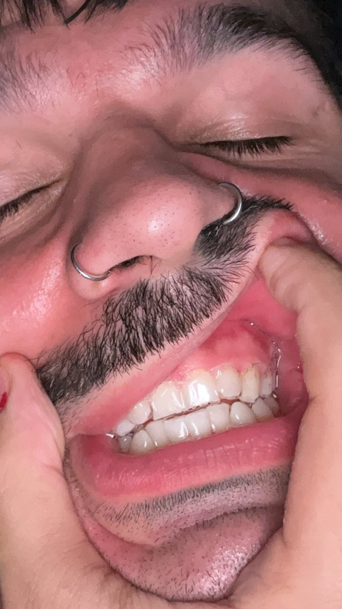 bigotitos2000's tweet image. Alcanzando el blanco dental de bad bunny y me queda la mitad todavía #Clix #Trident