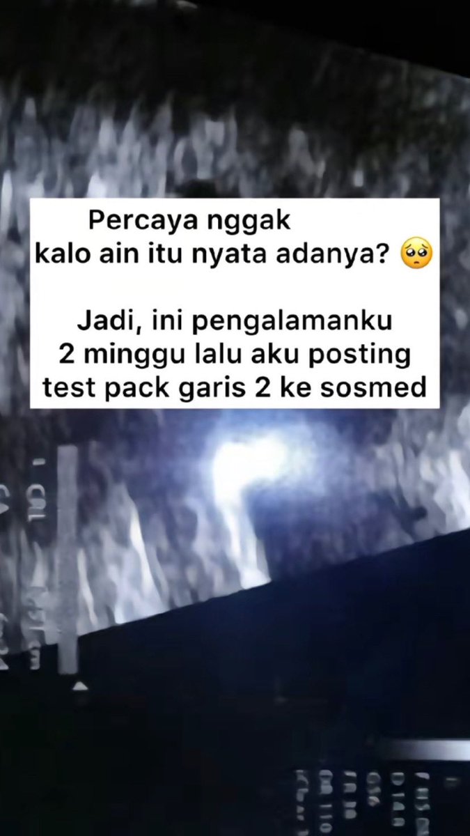 bukti nyata ain itu ada 
—
A Thread