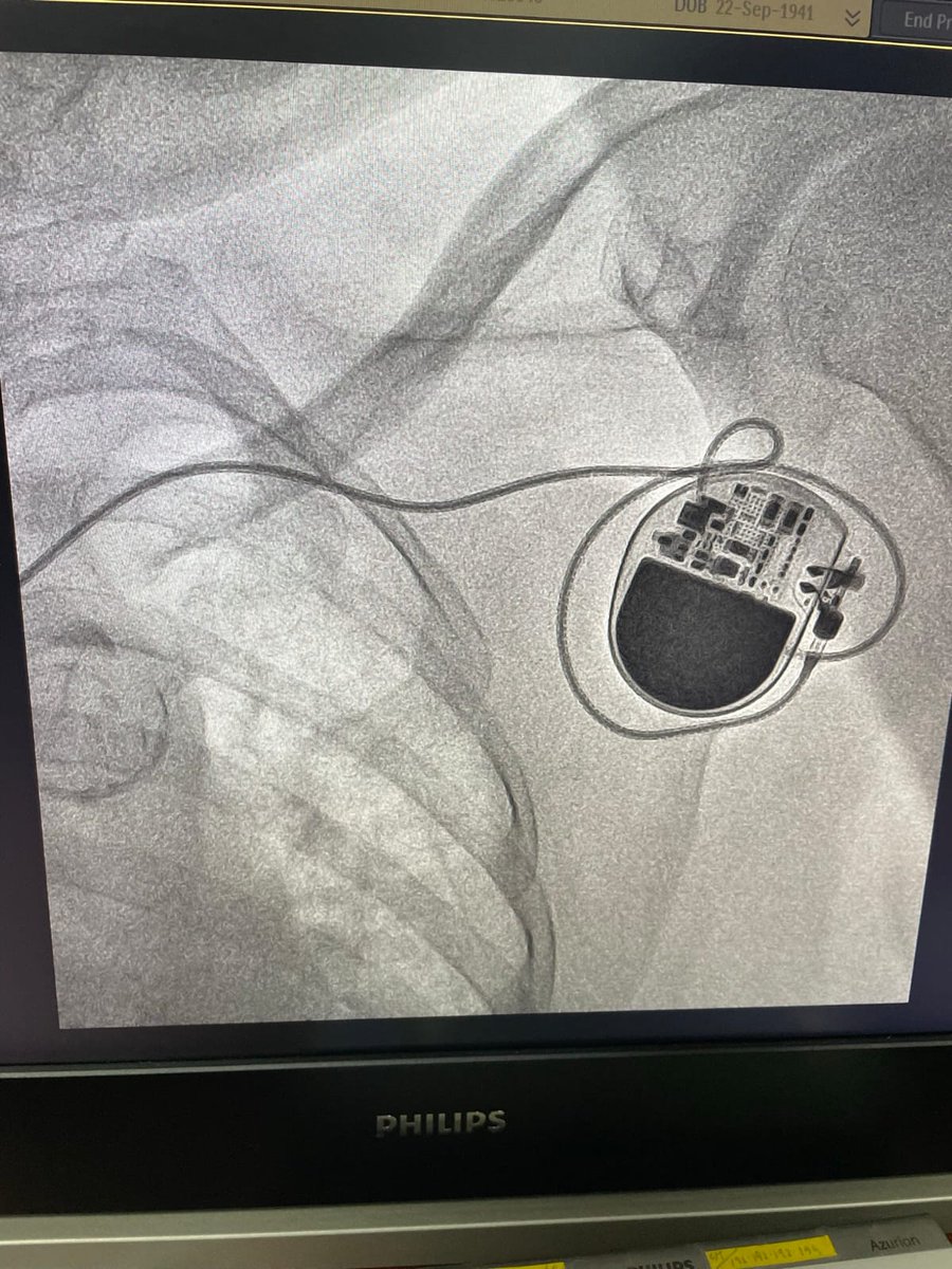 Thrilled to share that our actively functioning Cardiac Cath Lab at GB PANT HOSPITAL is up and running, already saving numerous lives across the Andaman and Nicobar Islands! Proud to provide advanced cardiac care to our community. #SavingLives #CardiacCare #AndamanAndNicobar