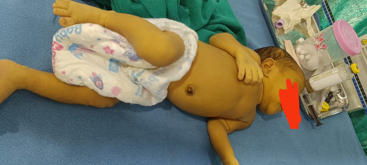 Guess the bilirubin level