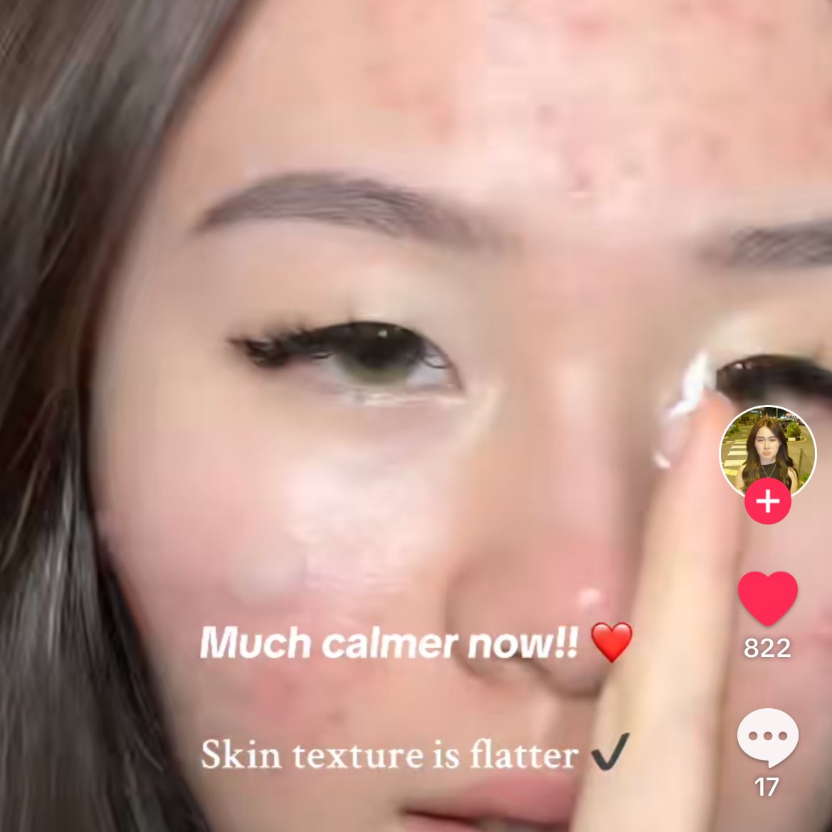 Any skincare yg ada CICA boleh helps calm your acne trust meh!

BUT HELLO?! I JE KE YG BARU TAHU WARDAH MEMANG ADA LAUNCH MOISTURIZERSSS NI?? Dah masuk malaysia ke belum nihhh😭🫵🏻