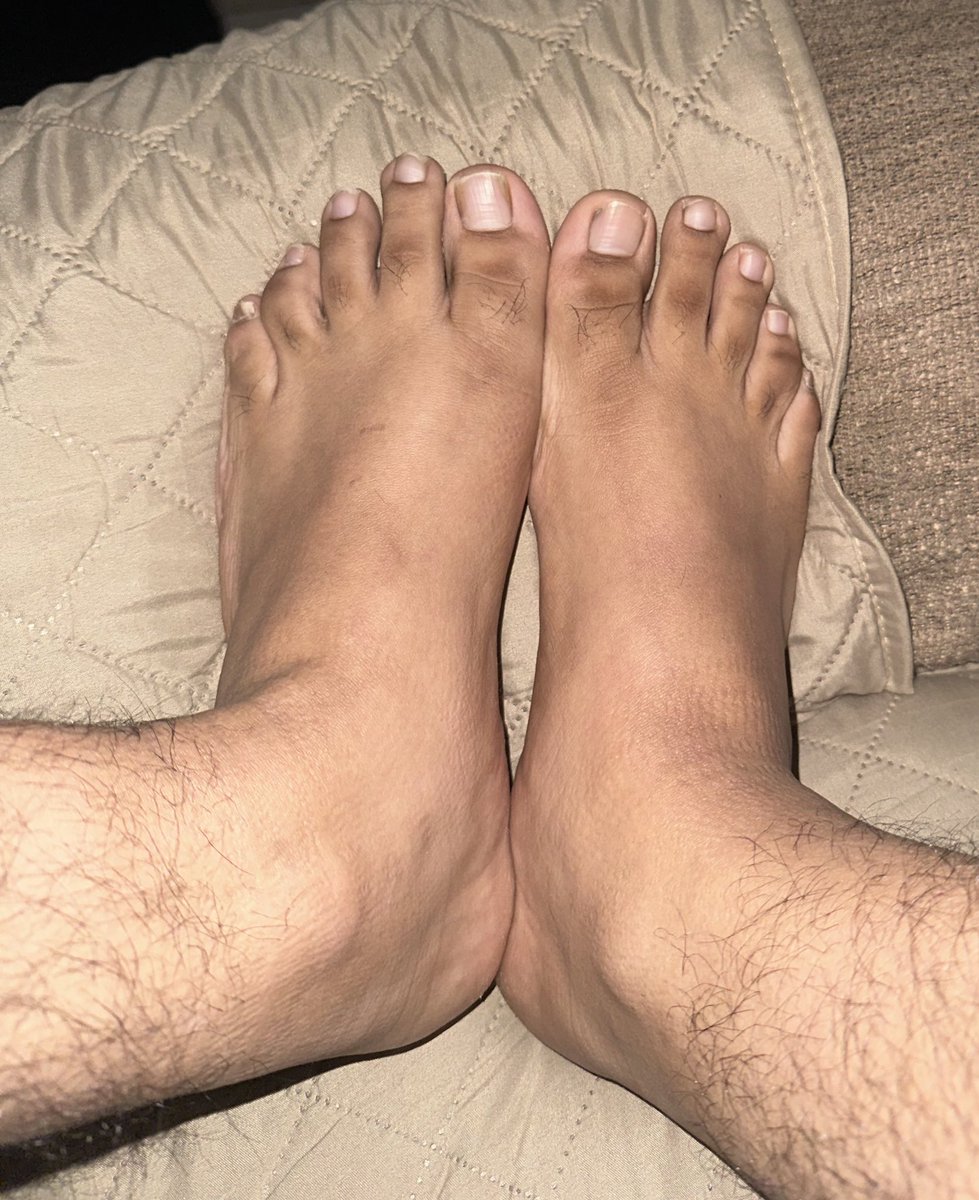 Mens feet tweet media