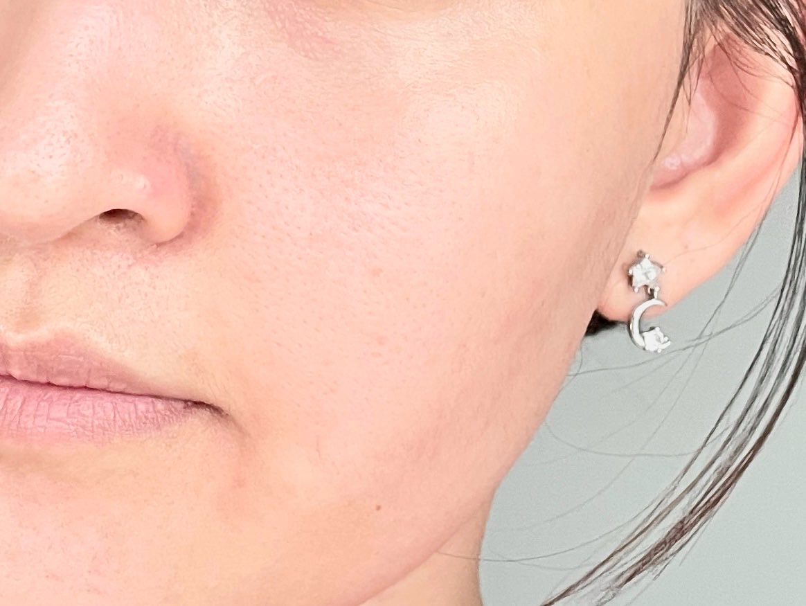 ttarntalzonel's tweet image. คนเป็นสิว ผิวมันต้องรักตัวนี้คือ เขาเป็นเซรั่ม Niacinamide เข้มข้น 22% เลยให้มาแบบจัดเต็มมาก แล้วยังมีตัว Glucobright มาด้วย
คือ เป็นส่วนผสมที่ลงตัวมากๆ ผิวใส รูขุมขนกริบ แถมหน้าไม่มัน ใครหาเซรั่ม
Niacinamide อยู่ต้องมีตัวนี้อะ
 #jkสกินแคร์ที่จริงใจกับผิวคุณ #JKxLAB