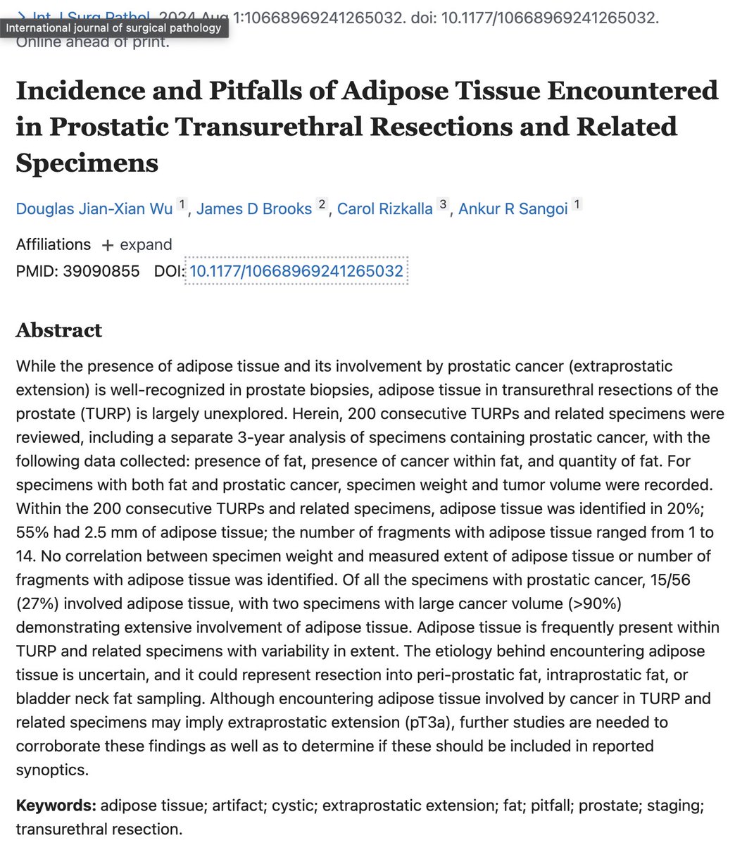 Carol N. Rizkalla (@carol2path) on Twitter photo Prostate cancer invading into fat in trans-urethral resections of the prostate (TURP) does NOT necessarily = extra-prostatic extension- see below 👇👇
Grateful to be included in this work <a href="/slusagar/">Ankur Sangoi</a> @stanfordpath
#GUpath #PathTwitter Prostate cancer invading into fat in trans-urethral resections of the prostate (TURP) does NOT necessarily = extra-prostatic extension- see below 👇👇
Grateful to be included in this work <a href="/slusagar/">Ankur Sangoi</a> @stanfordpath
#GUpath #PathTwitter