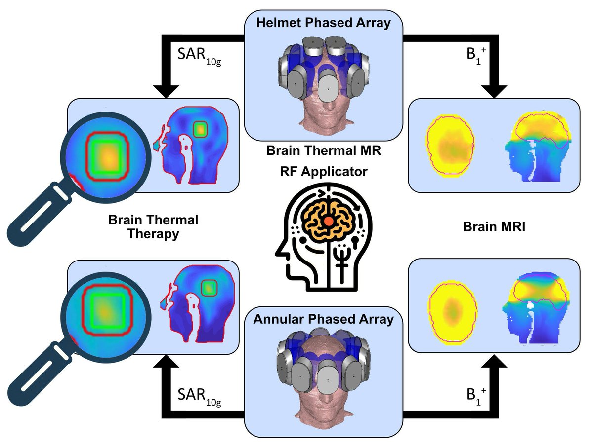 Bioeng_MDPI's tweet photo. 🌟 Excited to share the Editor’s Choice Paper: Helmet Radio Frequency Phased Array Applicators Enhance Thermal Magnetic Resonance of Brain Tumors👉 : https://t.co/NSymLBh8rB

#brain #tumor #glioblastoma #theranostics #temperature #hyperthermia #MRI #Thermal #Magnetic_Resonance https://t.co/8hrPHsPqHC