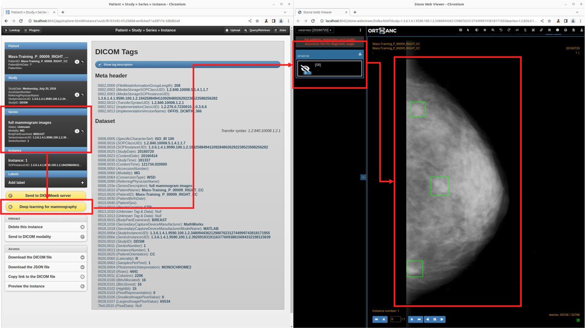 I was delighted to present our work entitled "Integrated and interoperable platform for detecting masses on mammograms" at #MIE2024! The source code of this project is evidently released as free and open-source software as a part of the Orthanc ecosystem. github.com/jodogne/orthan…