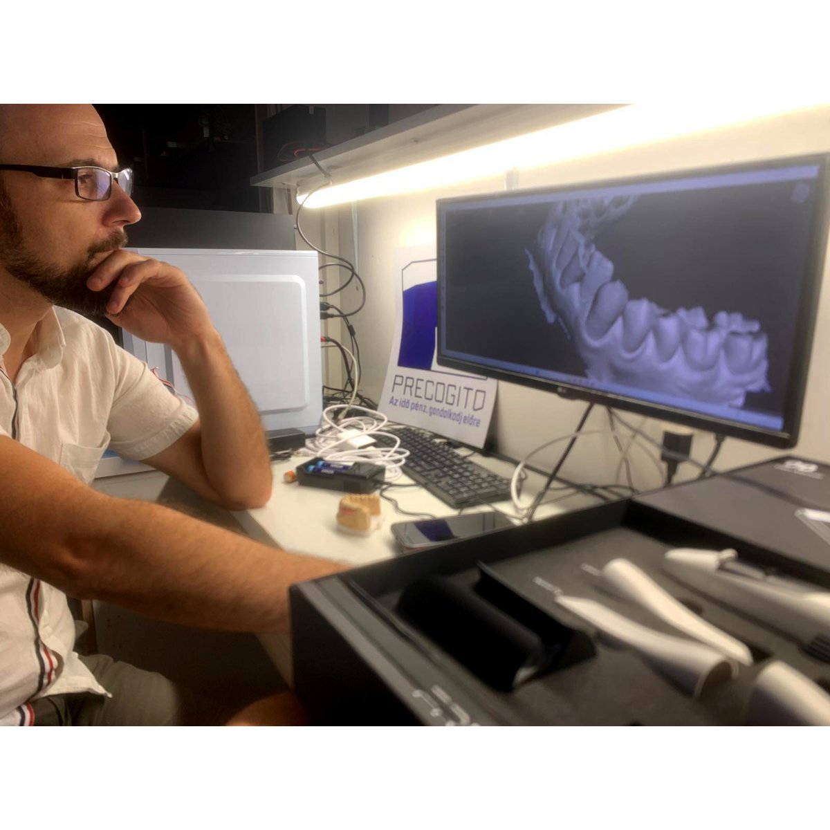 DOF's new partner in Hungary, Precogito, has just shared their first experience with the FREEDOM i.
Thank you for sharing your precise photo and experience!💙 Welcome aboard on your digital dentistry journey with DOF.
#DOF #Precogito #FREEDOMi #Hungary #IntraoralScanner