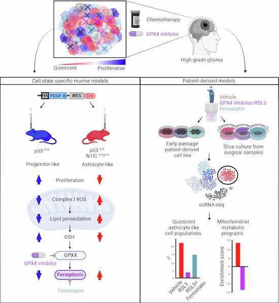 The EMBO Journal (@embojournal) on Twitter photo A cell state-specific metabolic vulnerability to GPX4-dependent ferroptosis in glioblastoma
<a href="/psimslab/">Peter Sims</a> <a href="/PCanoll/">Peter Canoll</a> <a href="/Columbia/">Columbia University</a> et al find quiescent astrocyte-like glioma cells show abnormal energy metabolism, sensitizing them to ferroptosis-inducing drugs
embopress.org/doi/full/10.10… A cell state-specific metabolic vulnerability to GPX4-dependent ferroptosis in glioblastoma
<a href="/psimslab/">Peter Sims</a> <a href="/PCanoll/">Peter Canoll</a> <a href="/Columbia/">Columbia University</a> et al find quiescent astrocyte-like glioma cells show abnormal energy metabolism, sensitizing them to ferroptosis-inducing drugs
embopress.org/doi/full/10.10…