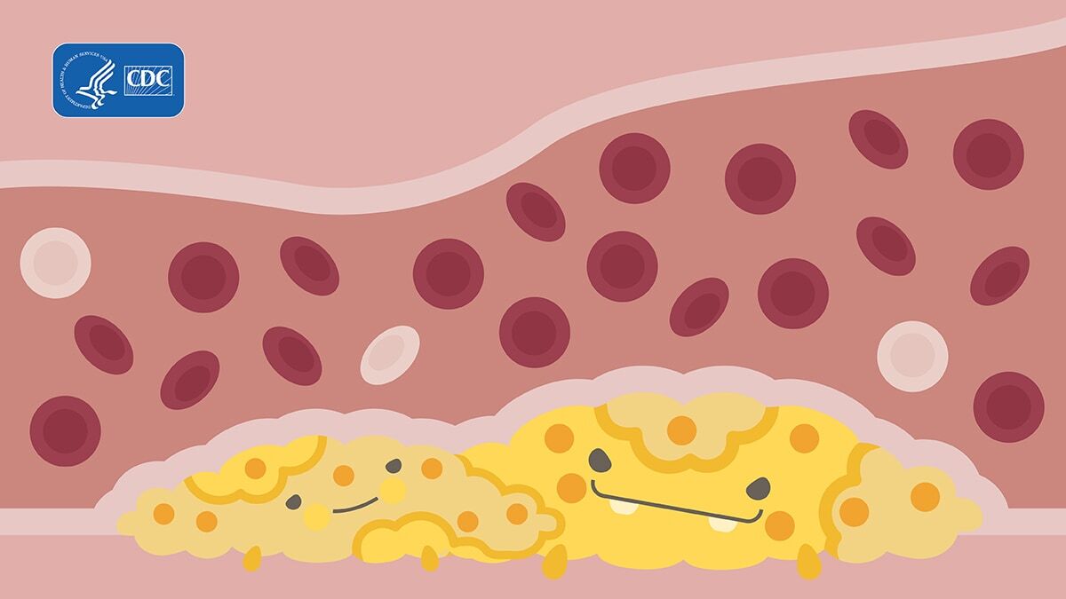 September is National Cholesterol Education Month. About 38% of American adults have high cholesterol. You can make healthy lifestyle choices every day to lower your risk.

Learn more here: cdc.gov/cholesterol/pr…