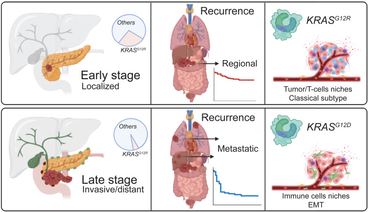 Online Now: The KRAS mutational spectrum and its clinical implications in pancreatic cancer dlvr.it/TCXSrH