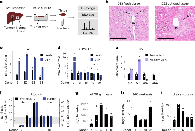 Online now! Global 13C tracing and metabolic flux analysis of intact human liver tissue ex vivo dlvr.it/TCX41y