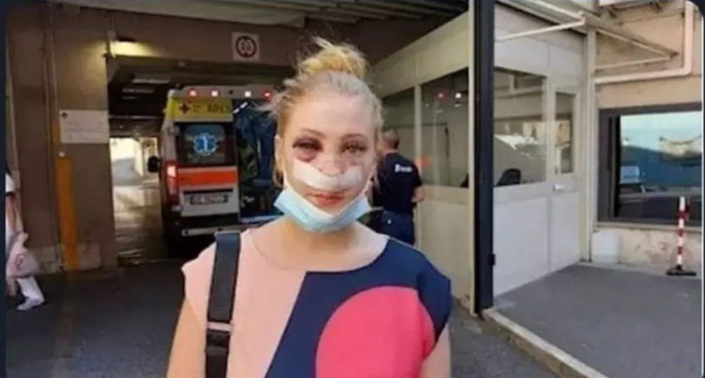 realMaalouf's tweet photo. A Norwegian female tourist in Italy was brutally attacked by an Iraqi immigrant for rejecting his sexual advances.

The man repeatedly called her a ‘Norwegian whore’ before assaulting and attempting to rape her.

She was left unconscious on the ground with a fractured nose. https://t.co/OO6xgsbDXw