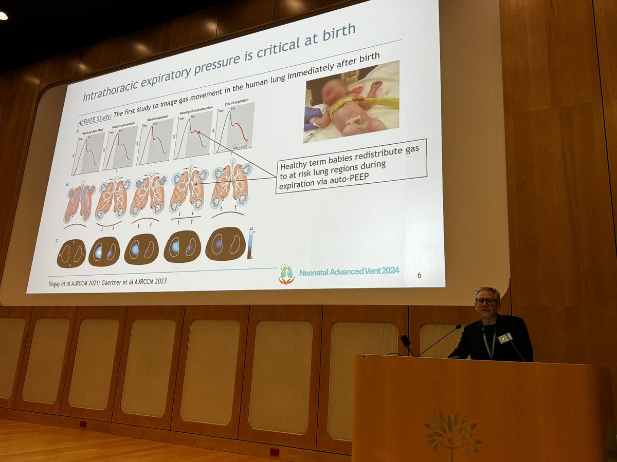 Arun Sett (@arunsett) on Twitter photo The first breath after birth is important. So is the next one, and the next one, and the next one… <a href="/DavidTingay/">David Tingay</a> encouraging us to rethink how we support the lungs at birth. <a href="/MCRI_for_kids/">Murdoch Children's Research Institute (MCRI)</a> #ADVENT The first breath after birth is important. So is the next one, and the next one, and the next one… <a href="/DavidTingay/">David Tingay</a> encouraging us to rethink how we support the lungs at birth. <a href="/MCRI_for_kids/">Murdoch Children's Research Institute (MCRI)</a> #ADVENT