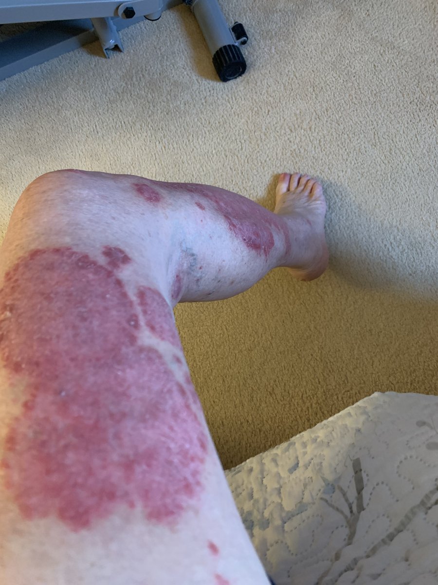 Bruce McGonigal tweet media