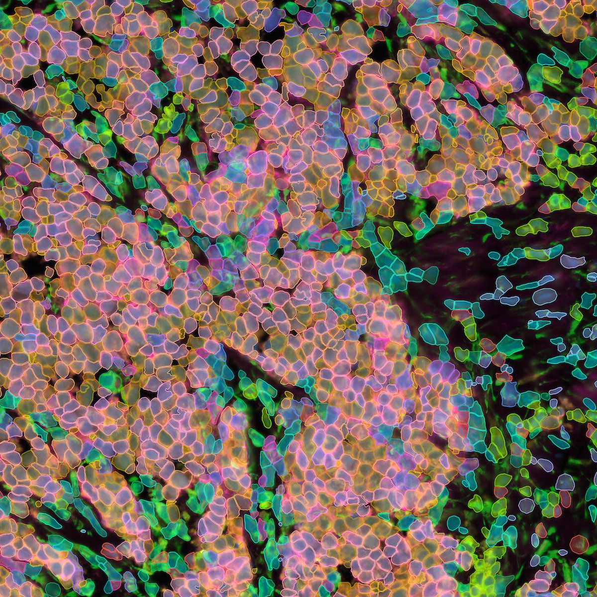 10xGenomics's tweet photo. How did #Immunooncology researchers use #singlecellspatial to map spatial biomarkers & differentiate treatment responders in four #breastcancer subtypes? Find out & see how Xenium helped make it happen in a new blog recap: https://t.co/4XMHeL4yKT https://t.co/UsmSMzucQc