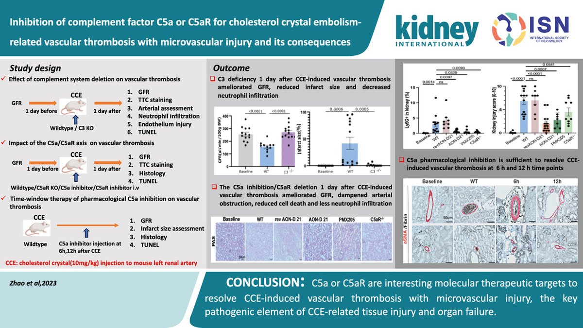 Kidney International (@kidney_int) on Twitter photo Inhibition of complement factor C5a or C5aR for cholesterol crystal embolism–related vascular thrombosis with microvascular injury and its consequences
doi: 10.1016/j.kint.2024.07.020
<a href="/LMU_Muenchen/">Universität München</a> <a href="/dzhk_germany/">DZHK Germany</a> <a href="/UniklinikAachen/">Uniklinik RWTH AC</a> <a href="/hjanders_hans/">Hans-Joachim Anders</a> <a href="/OhioStateNeph/">Ohio State Nephrology</a>
#AKI #diabetes Inhibition of complement factor C5a or C5aR for cholesterol crystal embolism–related vascular thrombosis with microvascular injury and its consequences
doi: 10.1016/j.kint.2024.07.020
<a href="/LMU_Muenchen/">Universität München</a> <a href="/dzhk_germany/">DZHK Germany</a> <a href="/UniklinikAachen/">Uniklinik RWTH AC</a> <a href="/hjanders_hans/">Hans-Joachim Anders</a> <a href="/OhioStateNeph/">Ohio State Nephrology</a>
#AKI #diabetes