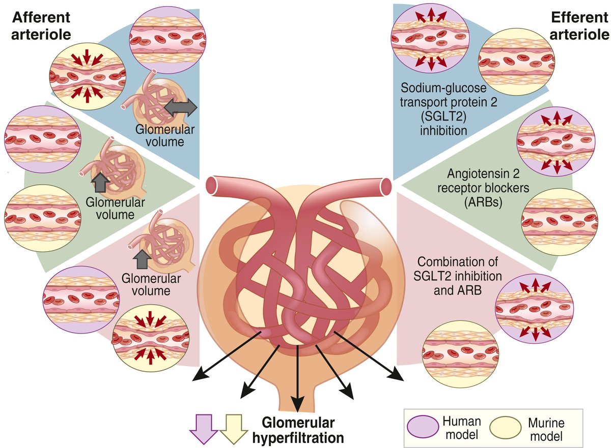 Kidney International (@kidney_int) on Twitter photo Deciphering the kidney hemodynamic effects of #SGLT2 inhibition: translating insights from rats to humans in type 2 diabetes
kidney-international.org/article/S0085-…
Original article:
kidney-international.org/article/S0085-…
<a href="/UWDeptMedicine/">UW Department of Medicine</a> <a href="/medcmuofficial/">คณะแพทยศาสตร์ มช. MedCMU</a>
#KICommentary #diabetes Deciphering the kidney hemodynamic effects of #SGLT2 inhibition: translating insights from rats to humans in type 2 diabetes
kidney-international.org/article/S0085-…
Original article:
kidney-international.org/article/S0085-…
<a href="/UWDeptMedicine/">UW Department of Medicine</a> <a href="/medcmuofficial/">คณะแพทยศาสตร์ มช. MedCMU</a>
#KICommentary #diabetes