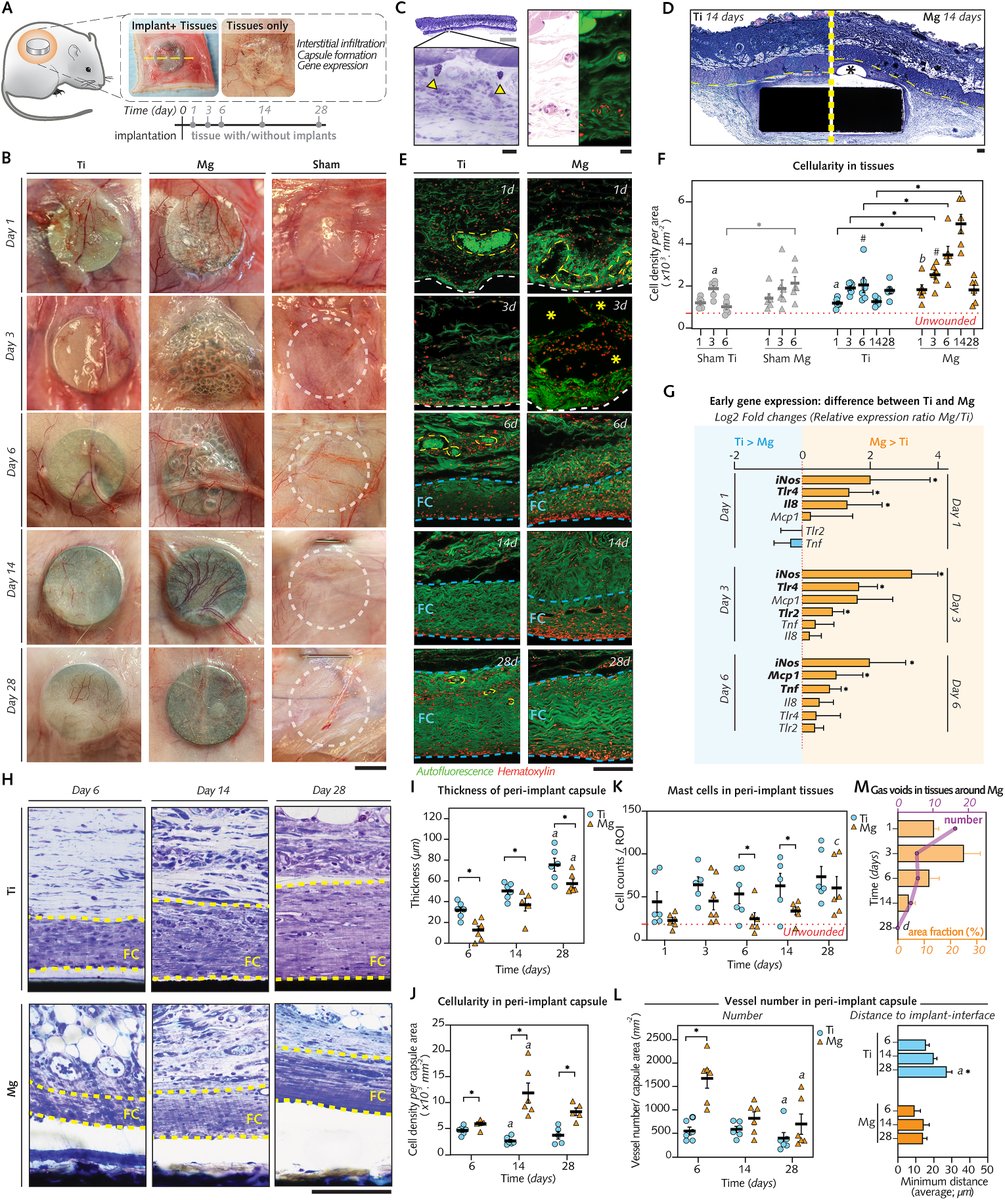 Furqan Shah (@shahfa_) on Twitter photo Reposting a fascinating paper by <a href="/heithem_ba/">Heithem Ben Amara</a> and <a href="/difam8/">Diana Martínez</a> in <a href="/BioactiveMat/">Bioactive Materials</a>
"Magnesium implant degradation provides immunomodulatory and proangiogenic effects and attenuates peri-implant fibrosis in soft tissues"
doi.org/10.1016/j.bioa…
#bone #biomaterials #implants #engineering Reposting a fascinating paper by <a href="/heithem_ba/">Heithem Ben Amara</a> and <a href="/difam8/">Diana Martínez</a> in <a href="/BioactiveMat/">Bioactive Materials</a>
"Magnesium implant degradation provides immunomodulatory and proangiogenic effects and attenuates peri-implant fibrosis in soft tissues"
doi.org/10.1016/j.bioa…
#bone #biomaterials #implants #engineering