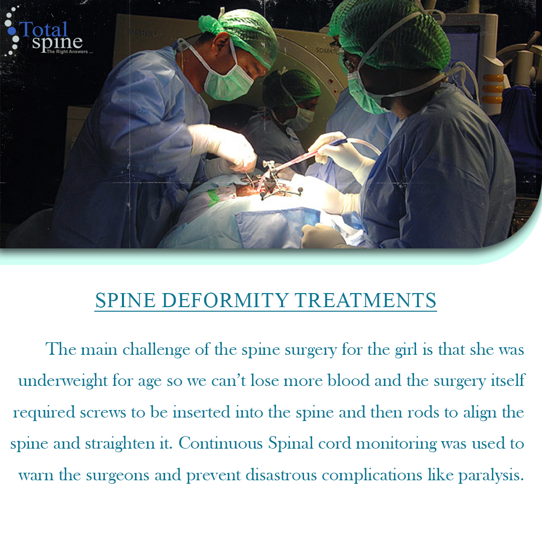 TotalSpine_in's tweet photo. Witness a Life Transformed 🌟 by Dr. Parthasarathy Srinivasan! Discover how our expert spine deformity treatment changed one patient's life. Ready for your success story? Contact us today! 

#TotalSpineSuccess #SpineHealth #ChennaiSpineCare https://t.co/w1YvbjnSGf