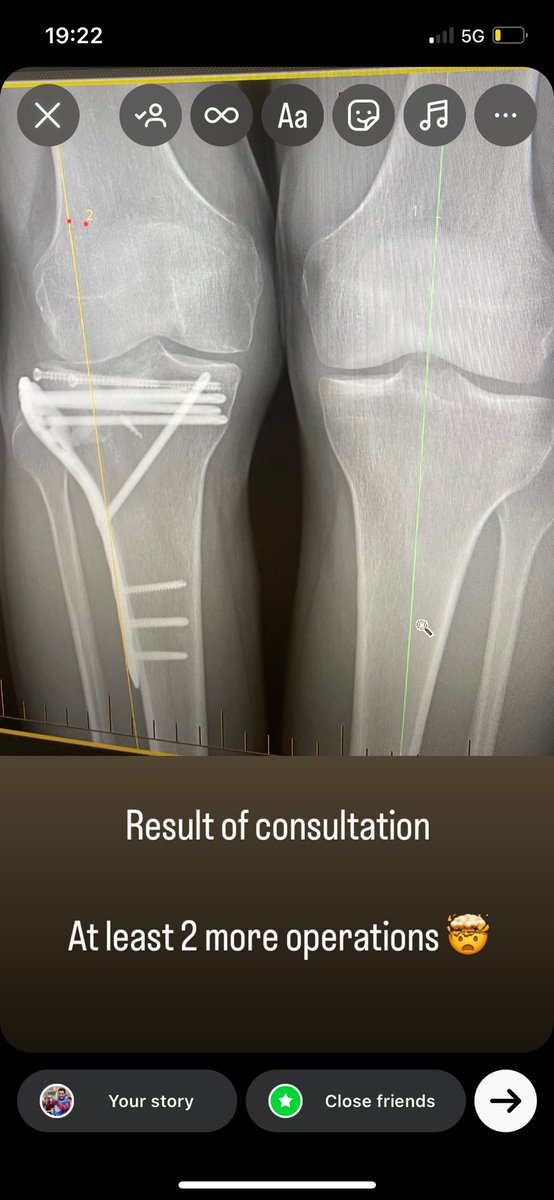 Aidan Coleman tweet media