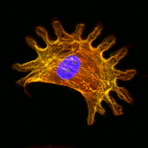 Igniting a new ‘wave’ of atrial fibrillation research by Aaron Johnston <a href="/UniofOxford/">University of Oxford</a>
