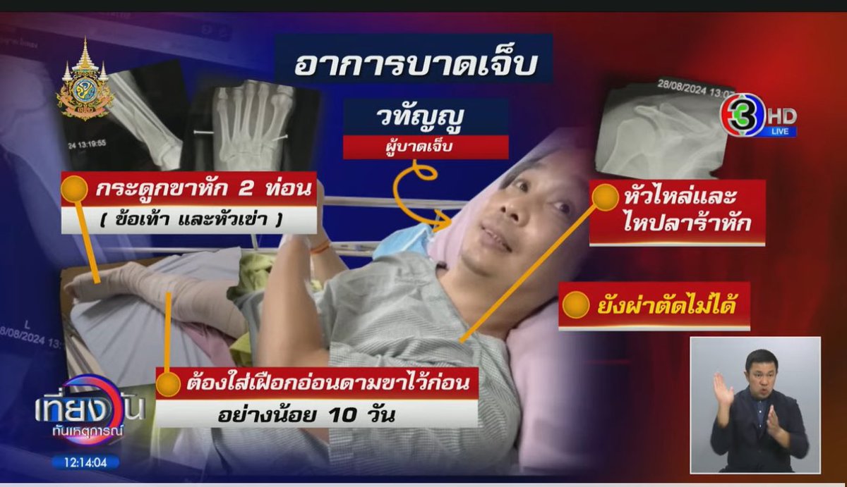 RedSkullxxx's tweet photo. เรียบร้อยไอ้สัส ถ้าหนักหน่อยก็พยามยามฆ่า แต่คุกแน่นอน มองไกลๆลายเสื้อคุ้นๆ มีไม่กี่กลุ่มหรอก ทะเบียนชัดซุ้มล้อตามสไตล์ไอ้พวกขยะนี่เลย #ควายหลุดถนน #เฮียขับรถ https://t.co/s0weX2ARRN