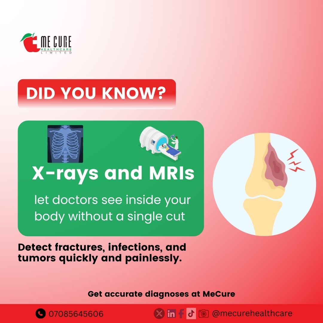 MeCureHealth's tweet photo. Discover the power of X-rays and MRIs! Visit MeCure for state-of-the-art imaging services.
#MedicalImaging #Xray #MRI #MeCureHealthcare #Mecurediagnosis #MeCurecares #MeCure https://t.co/cMKy2L2U7x