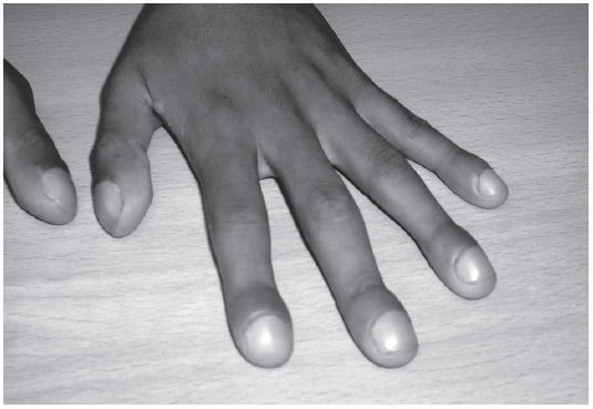 GSFronteras's tweet photo. Maybe for #BenDaniels from #LordofTheRingsTheRingsOfPower would be necessary a full check for her personal doctor. In this frame of the Chap1 of the Season 2 it's seen acropachy (nail clubbing), which is seen in people with pulmonar diseases, such lung cancer, lung fibrosis, etc https://t.co/qd8w04RNRK