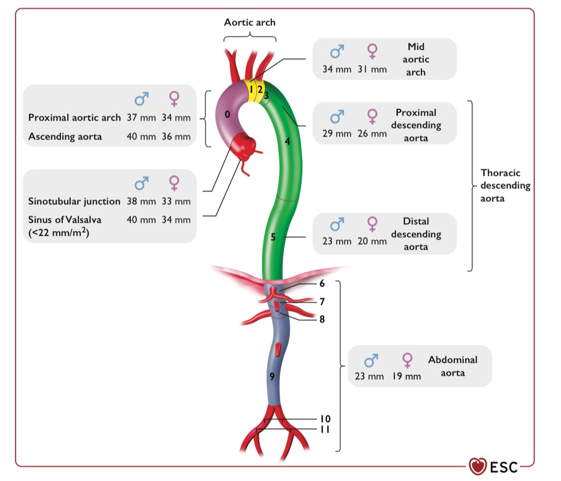 Javier Torres (@jtllergo) on Twitter photo ⚠️ 2024 ESC Guidelines for the management of peripheral arterial and aortic diseases‼️
<a href="/ESC_Journals/">European Society of Cardiology Journals</a> <a href="/secardiologia/">Soc Esp Cardiología</a> <a href="/clinica_sec/">Asociación Cardiología Clínica SEC</a> <a href="/SACardiologia/">SACardiología</a> <a href="/preventiva_SEC/">Cardiología Preventiva</a> <a href="/RevEspCardiol/">REC Publications</a>
escardio.org/Guidelines/Cli… ⚠️ 2024 ESC Guidelines for the management of peripheral arterial and aortic diseases‼️
<a href="/ESC_Journals/">European Society of Cardiology Journals</a> <a href="/secardiologia/">Soc Esp Cardiología</a> <a href="/clinica_sec/">Asociación Cardiología Clínica SEC</a> <a href="/SACardiologia/">SACardiología</a> <a href="/preventiva_SEC/">Cardiología Preventiva</a> <a href="/RevEspCardiol/">REC Publications</a>
escardio.org/Guidelines/Cli…
