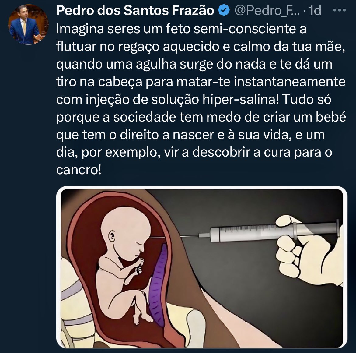Aborto:

A mulher decide.
A sociedade respeita.
O Estado garante.
A igreja não interfere.

E, como é óbvio, o aborto não é feito assim.