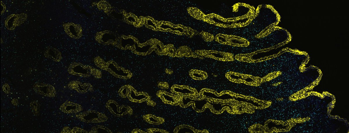 Globally, millions of individuals are affected by endometrial / uterine disorders, yet the #endometrium and the role of its #cellular #heterogeneity in these disorders have been hugely understudied compared with other human tissues and diseases.
