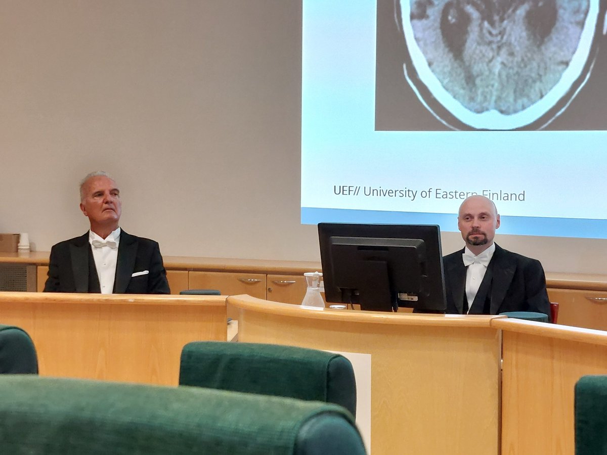 Reetta Kälviäinen (@rkalviainen) on Twitter photo Dissertation of Ville Korhonen <a href="/UEFneuroscience/">UEF Neuroscience</a> of comorbidity between idiopathic normal pressure hydrocephalus and frontotemporal dementia
uef.fi/fi/artikkeli/l… Dissertation of Ville Korhonen <a href="/UEFneuroscience/">UEF Neuroscience</a> of comorbidity between idiopathic normal pressure hydrocephalus and frontotemporal dementia
uef.fi/fi/artikkeli/l…