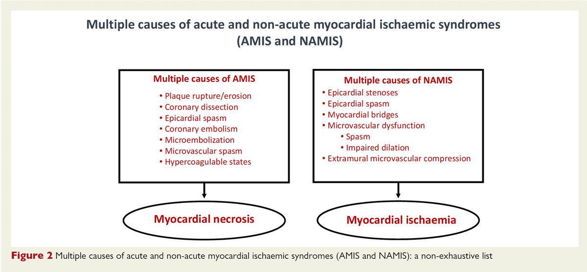 SINDROME DE ISQUEMIA MIOCÁRDICA
Nueva nomenclatura

🔴Aguda (AMIS)⏩ Estenosis coronaria / INOCA
🔴Crónica (NAMIS)⏩ Síndrome coronario agudo por accidente de placa / MINOCA

#ESCCongress 
academic.oup.com/eurheartj/adva…