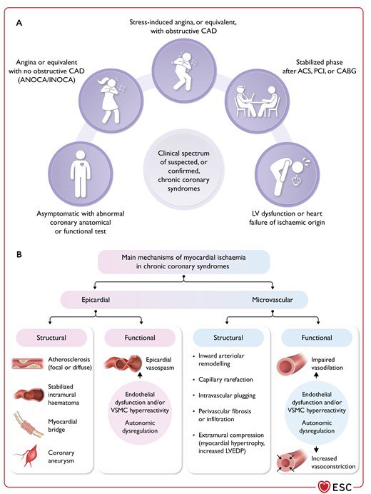 Eva Rumiz (@evarumiz) on Twitter photo New recommendations from the 2024 ESC Guidelines on CCS for INOCA/ANOCA 🔝. <a href="/secardiologia/">Soc Esp Cardiología</a> <a href="/shci_sec/">ACI-SEC: Hemodinamica</a> <a href="/JEscaned/">Javier Escaned</a> <a href="/ramonlopezpalop/">Ramón López Palop</a> <a href="/fer_iver/">Fernando Rivero</a> <a href="/belcid7/">Belén Cid Alvarez</a> <a href="/ErnestoValero84/">Ernesto Valero</a>
🥇Coronary función test (CFT) to identify INOCA/ANOCA endotypes: IB
🥈Medical treatment guided by CFT: IIa. New recommendations from the 2024 ESC Guidelines on CCS for INOCA/ANOCA 🔝. <a href="/secardiologia/">Soc Esp Cardiología</a> <a href="/shci_sec/">ACI-SEC: Hemodinamica</a> <a href="/JEscaned/">Javier Escaned</a> <a href="/ramonlopezpalop/">Ramón López Palop</a> <a href="/fer_iver/">Fernando Rivero</a> <a href="/belcid7/">Belén Cid Alvarez</a> <a href="/ErnestoValero84/">Ernesto Valero</a>
🥇Coronary función test (CFT) to identify INOCA/ANOCA endotypes: IB
🥈Medical treatment guided by CFT: IIa.