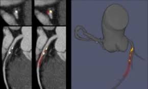 Manish Motwani (@doc_tiger) on Twitter photo Interested in AI 🤖 & cardiovascular CT #yesCCT …but not sure where to start 🤷🏻♂️🤷♀️? ➡️Check out the definitive <a href="/Heart_SCCT/">Heart_SCCT</a> AI/ML white paper 👉🏼
authors.elsevier.com/sd/article/S19… - by <a href="/imagingmedsci/">imagingmedsci</a> & other bots Interested in AI 🤖 & cardiovascular CT #yesCCT …but not sure where to start 🤷🏻♂️🤷♀️? ➡️Check out the definitive <a href="/Heart_SCCT/">Heart_SCCT</a> AI/ML white paper 👉🏼
authors.elsevier.com/sd/article/S19… - by <a href="/imagingmedsci/">imagingmedsci</a> & other bots