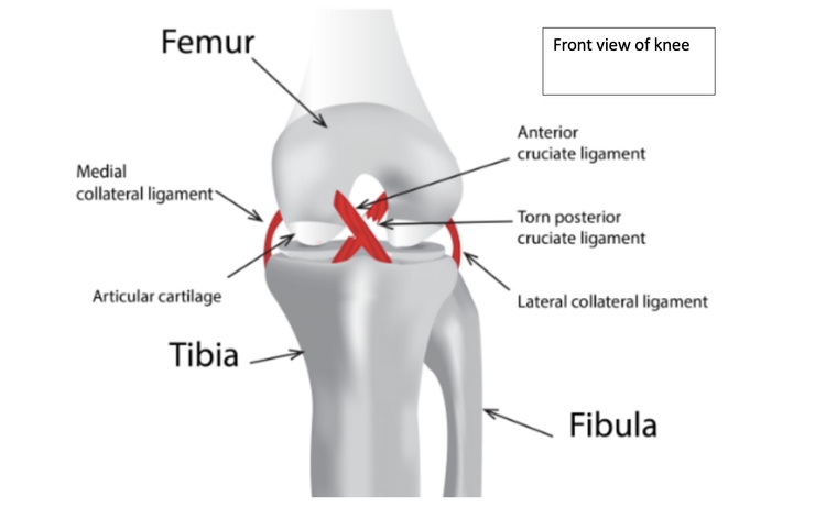 I just published Expert Care for Ligament and Knee Injuries in London link.medium.com/COmX2z2VtMb