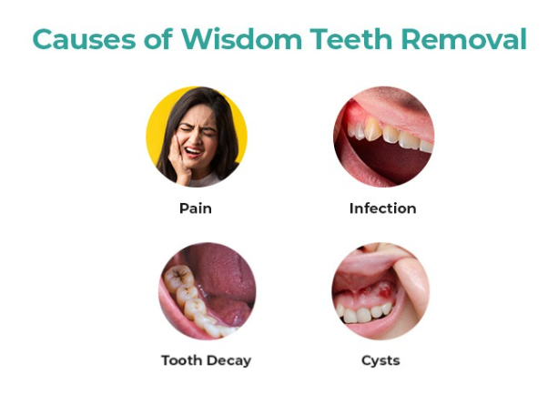 StDentistry's tweet image. Do you have questions about wisdom teeth removal? 🤔 

Whether it’s pain, infection, or just regular check-ups, understanding the types of impaction can help you make informed decisions. Drop your questions below to get personalized advice! 

#AskTheDentist #WisdomTeethRemoval