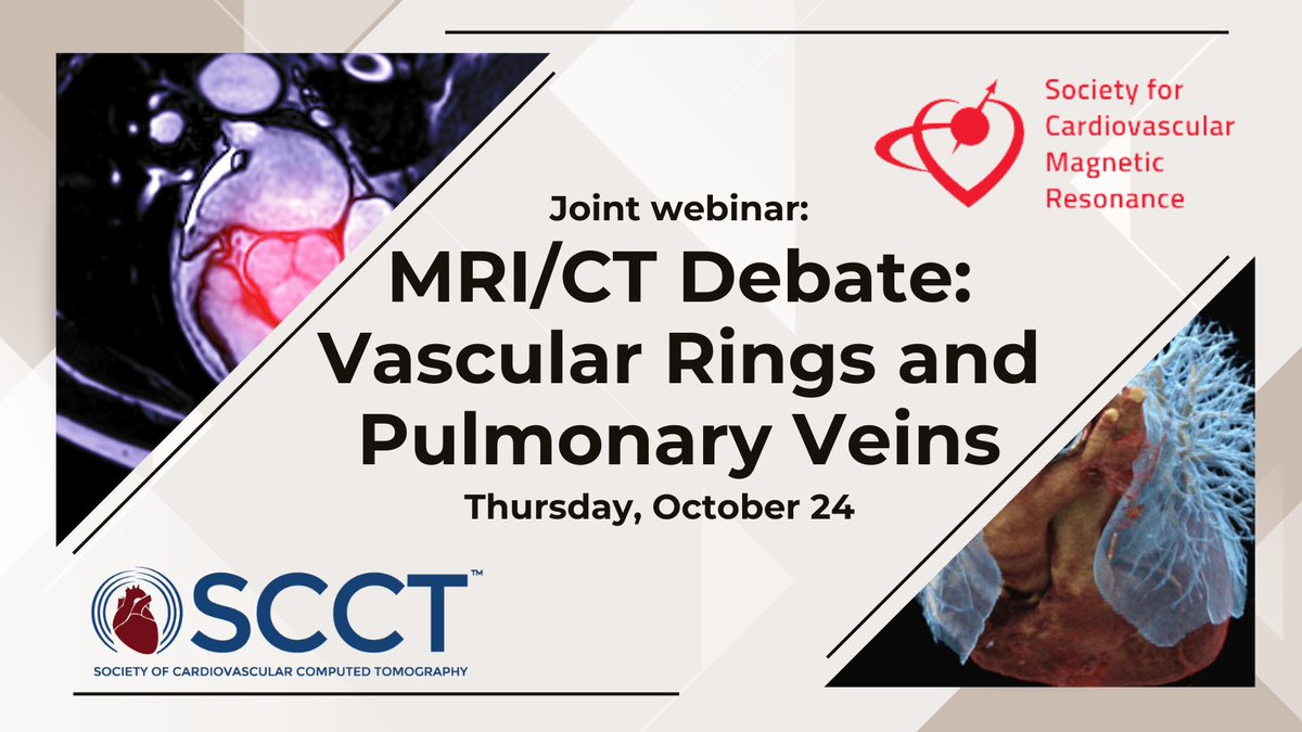 Heart_SCCT (@heart_scct) on Twitter photo Join <a href="/Heart_SCCT/">Heart_SCCT</a> and <a href="/SCMRorg/">Society for Cardiovascular Magnetic Resonance</a> for a joint webinar on Oct 24 at 12noon ET. Chaired by <a href="/saira67/">Saira Siddiqui</a> and <a href="/SimoneJhaveriMD/">Simone Jhaveri MD</a>
Learn more: ow.ly/w9F150T1oRH Join <a href="/Heart_SCCT/">Heart_SCCT</a> and <a href="/SCMRorg/">Society for Cardiovascular Magnetic Resonance</a> for a joint webinar on Oct 24 at 12noon ET. Chaired by <a href="/saira67/">Saira Siddiqui</a> and <a href="/SimoneJhaveriMD/">Simone Jhaveri MD</a>
Learn more: ow.ly/w9F150T1oRH