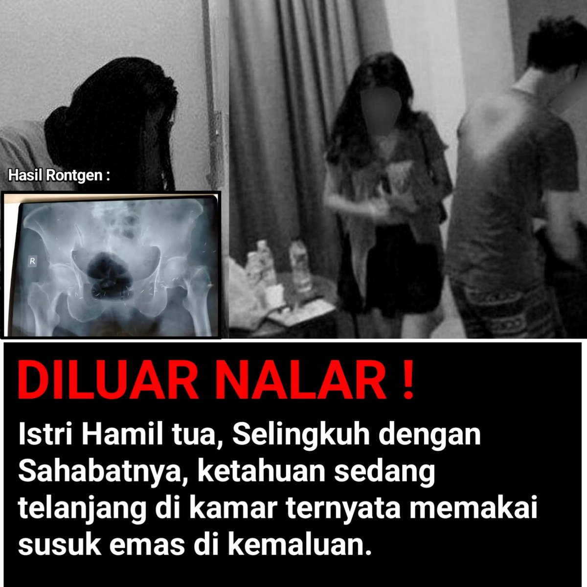 Lakonstory's tweet photo. Hamil tua, Ditinggal selingkuh, memergoki suaminya sedang berduaan dikamar sahabatnya dg telanjang bulat.

Beberapa kali bundir, Stlh tertangkap trtnyt efek susuk emas. Susuknya smpai dipasang di kemaluan.

Thread 21+

Miris banget nih cerita,
Ayo dibaca biar tau bhy dari susuk. https://t.co/iGLm4pUID1
